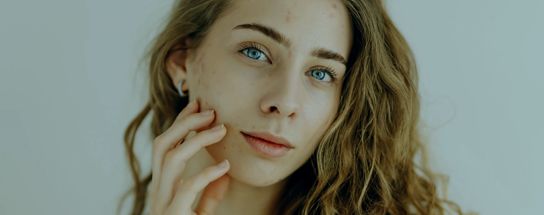 Skin Tone & Pigmentation