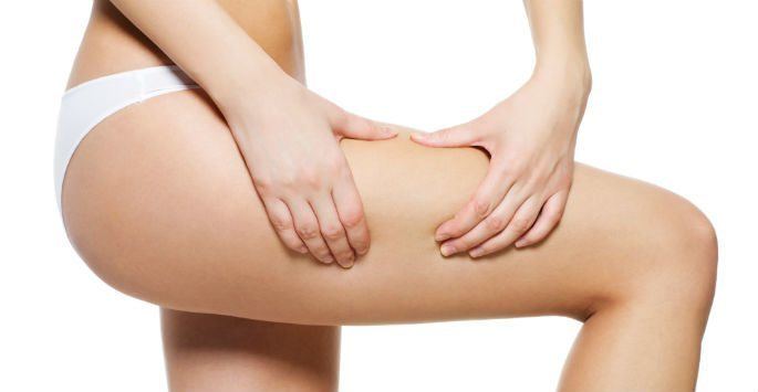 Lipedema Liposuction